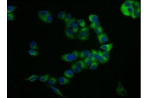 Immunofluorescence staining of PC-3 cells with ABIN7147167 at 1:133, counter-stained with DAPI. (CD59 抗体  (AA 26-102))