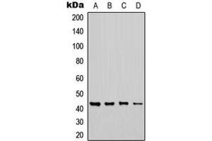 Western blot analysis of CHST6 expression in MCF7 (A), Jurkat (B), NS-1 (C), H9C2 (D) whole cell lysates. (CHST6 抗体  (C-Term))