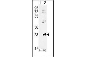 Western blot analysis of AK1 (arrow) using rabbit polyclonal AK1 Antibody (S45) (ABIN392794 and ABIN2842231). (Adenylate Kinase 1 抗体  (N-Term))