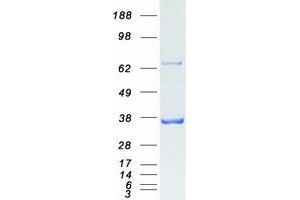 Western Blotting (WB) image for PDZ and LIM Domain 1 (PDLIM1) protein (Myc-DYKDDDDK Tag) (ABIN2728578)