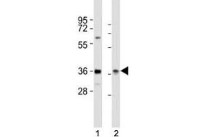 Western Blotting (WB) image for anti-Paired Box 4 (PAX4) (AA 171-200) antibody (ABIN3032125)