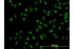 Image no. 3 for anti-Zinc Finger Protein 143 (ZNF143) (AA 1-627) antibody (ABIN466122)