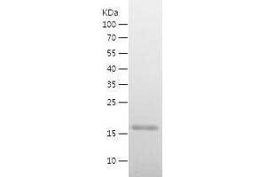 Western Blotting (WB) image for Myoglobin (MB) (AA 2-154) protein (His tag) (ABIN7282779) (Myoglobin Protein (MB) (AA 2-154) (His tag))