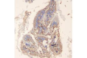 IHC analysis of TRAF6 using anti-TRAF6 antibody (ABIN7600026). (TRAF6 抗体  (AA 14-512))