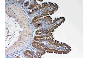 Immunohistochemistry (IHC) image for anti-Galactosamine (N-Acetyl)-6-Sulfate Sulfatase (GALNS) (AA 181-289) antibody (ABIN5693230)