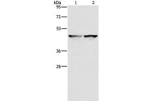 Western Blot analysis of 231 and hela cell using IDH1 Polyclonal Antibody at dilution of 1:550 (IDH1 抗体)