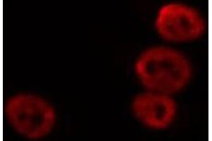 ABIN6269376 staining HeLa cells by IF/ICC.
