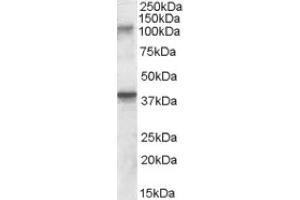 Image no. 1 for anti-Glutamate Receptor, Ionotropic, Kainate 3 (GRIK3) (Internal Region) antibody (ABIN375008) (GRIK3 抗体  (Internal Region))