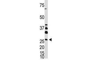 Image no. 1 for anti-Dickkopf Homolog 4 (Xenopus Laevis) (DKK4) (AA 7-36), (N-Term) antibody (ABIN357073) (DKK4 抗体  (N-Term))