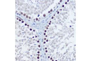 Immunohistochemistry of paraffin-embedded rat testis using Aurora B Rabbit pAb (ABIN7265783) at dilution of 1:150 (40x lens). (Aurora Kinase B 抗体  (AA 1-344))