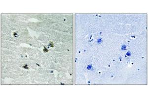 Immunohistochemical analysis of paraffin-embedded human brain tissue using MER/SKY (Phospho-Tyr749/681) antibody (left)or the same antibody preincubated with blocking peptide (right). (MerTK/Tyro3 抗体  (pTyr681, pTyr749))