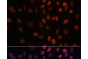 Immunofluorescence analysis of C6 cells using ARID1B Polyclonal Antibody at dilution of 1:100. (ARID1B 抗体)