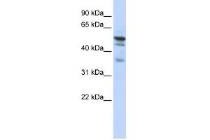 NMT1 antibody used at 1 ug/ml to detect target protein. (NMT1 抗体  (N-Term))