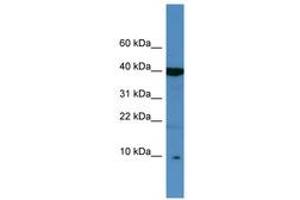 Image no. 1 for anti-serine Peptidase Inhibitor, Kazal Type 6 (SPINK6) (C-Term) antibody (ABIN6746431) (SPINK6 抗体  (C-Term))