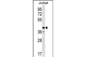 Western blot analysis in Jurkat cell line lysates (35ug/lane). (GORASP2 抗体  (AA 185-214))