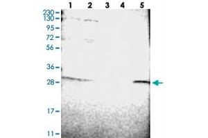 Western blot analysis of Lane 1: RT-4, Lane 2: U-251 MG, Lane 3: Human Plasma, Lane 4: Liver, Lane 5: Tonsil with ERGIC1 polyclonal antibody  at 1:250-1:500 dilution.