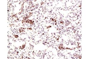 Immunohistochemistry (Paraffin-embedded Sections) (IHC (p)) image for anti-DNA (Cytosine-5)-Methyltransferase 1 (DNMT1) (AA 21-120) antibody (ABIN671796)