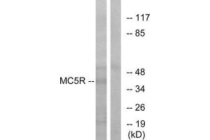 Western Blotting (WB) image for anti-Melanocortin 5 Receptor (MC5R) (C-Term) antibody (ABIN1853066) (MC5 Receptor 抗体  (C-Term))