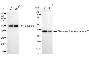 Western blotting analysis using Chromosome 3 open reading frame 38 antibody (ABIN7798079).