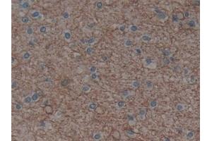 Detection of AQP4 in Human Brain Tissue using Polyclonal Antibody to Aquaporin 4 (AQP4) (Aquaporin 4 抗体  (AA 178-317))