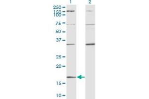 Western Blot analysis of RARRES2 expression in transfected 293T cell line by RARRES2 monoclonal antibody (M02), clone 3E3. (Chemerin 抗体  (AA 17-163))