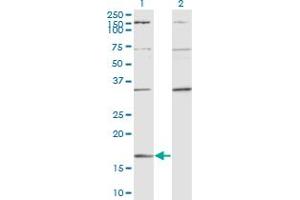 Western Blot analysis of RARRES2 expression in transfected 293T cell line by RARRES2 monoclonal antibody (M02), clone 3E3.