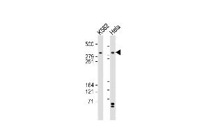 All lanes : Anti-TRR Antibody (C-term) at 1:2000 dilution Lane 1: K562 whole cell lysates Lane 2: Hela whole cell lysates Lysates/proteins at 20 μg per lane. (TRRAP 抗体  (C-Term))