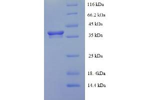 HEBP2 Protein (AA 2-205) (His-SUMO Tag)