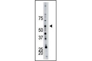 Image no. 1 for anti-6-phosphofructo-2-Kinase/fructose-2,6-Biphosphatase 4 (PFKFB4) (AA 274-303) antibody (ABIN360670) (PFKFB4 抗体  (AA 274-303))