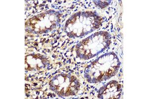 Immunohistochemistry of paraffin-embedded Human colon using  Rabbit pAb (ABIN6133192, ABIN6137243, ABIN6137244 and ABIN6223255) at dilution of 1:100 (40x lens). (ATG10 抗体  (AA 1-220))