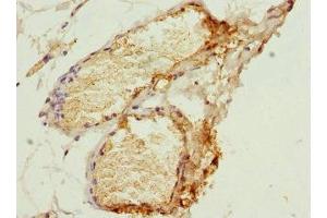 Immunohistochemistry of paraffin-embedded human plasma tissue using ABIN7155026 at dilution of 1:100 (SERPIND1 抗体  (AA 20-290))