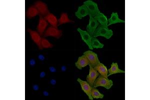 ABIN6258220 and ABIN6275062 staining Hela cells by IF/ICC.