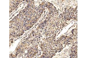 IHC analysis of SCRN1 using anti-SCRN1 antibody (ABIN7602923). (Secernin 1 抗体  (C-Term))