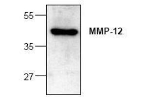 Image no. 1 for anti-Matrix Metallopeptidase 12 (Macrophage Elastase) (MMP12) antibody (ABIN127325) (MMP12 抗体)