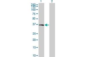 Western Blot analysis of MEOX2 expression in transfected 293T cell line by MEOX2 monoclonal antibody (M10), clone 4E10. (MEOX2 抗体  (AA 1-303))