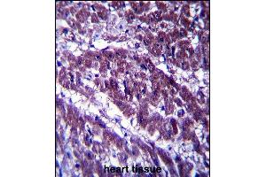 OGDH Antibody (C-term) (ABIN657365 and ABIN2846412) immunohistochemistry analysis in formalin fixed and paraffin embedded human heart tissue followed by peroxidase conjugation of the secondary antibody and DAB staining. (alpha KGDHC 抗体  (C-Term))