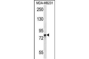 Western blot analysis in MDA-MB231 cell line lysates (35ug/lane). (PADI2 抗体  (C-Term))