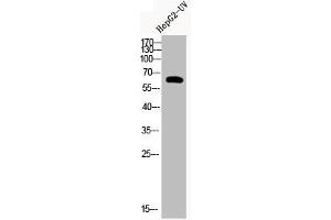 Western Blot analysis of HEPG2-UV cells using Acetyl-Cortactin (K235) Polyclonal Antibody (Cortactin 抗体  (acLys235))