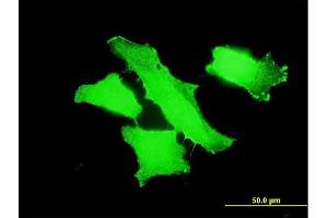 Immunofluorescence of monoclonal antibody to MPP1 on HeLa cell. (MPP1 抗体  (AA 1-466))