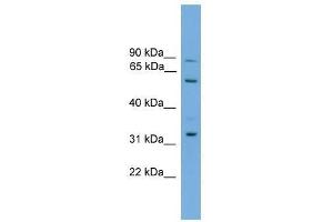 Western Blot showing PTDSS2 antibody used at a concentration of 1-2 ug/ml to detect its target protein. (PTDSS2 抗体  (Middle Region))