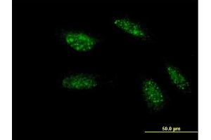 Immunofluorescence of monoclonal antibody to TWIST1 on HeLa cell. (TWIST1 抗体  (AA 100-202))