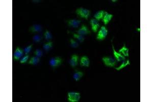 Immunofluorescence staining of Hela cells with ABIN7167999 at 1:100, counter-stained with DAPI. (ROCK1 抗体  (AA 405-668))