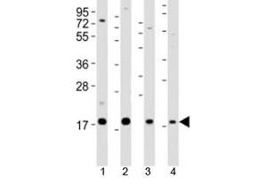 Western blot testing of Shh antibody at 1:2000 dilution. (Sonic Hedgehog 抗体  (N-Term))