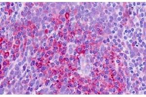 Immunohistochemistry (IHC) image for anti-Solute Carrier Family 11 (Proton-Coupled Divalent Metal Ion Transporters), Member 1 (SLC11A1) (AA 250-276) antibody (ABIN1804590)