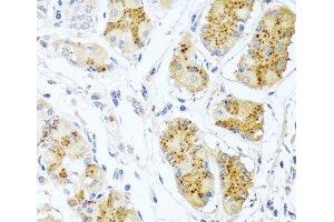 Immunohistochemistry of paraffin-embedded Human stomach using Endothelin 1 Polyclonal Antibody at dilution of 1:100 (40x lens). (Endothelin 1 抗体)