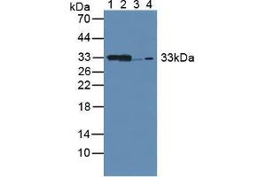Western blot analysis of (1) Mouse Kidney Tissue, (2) Mouse Liver Tissue, (3) Rat Kidney Tissue and (4) Human 293T Cells. (CBR1 抗体  (AA 66-271))