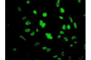 Immunofluorescence (IF) image for anti-Inhibitor of DNA Binding 1, Dominant Negative Helix-Loop-Helix Protein (ID1) (AA 1-155) antibody (ABIN561408)