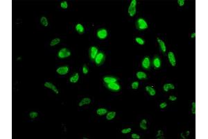 Immunofluorescence of monoclonal antibody to ID1 on HeLa cell. (ID1 抗体  (AA 1-155))