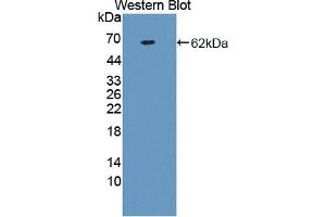 WB of Protein Standard: different control antibodies against Highly purified E. (Prothrombin Fragment 1+2 ELISA 试剂盒)