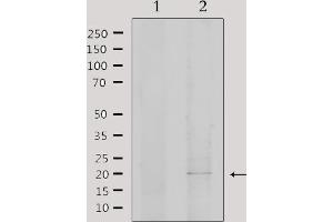 Western blot analysis of extracts from 293, using EID1 Antibody. (EID1 抗体  (Internal Region))